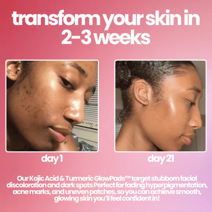 Turmeric and Kojic Acid Pads