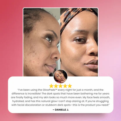 Turmeric and Kojic Acid Pads